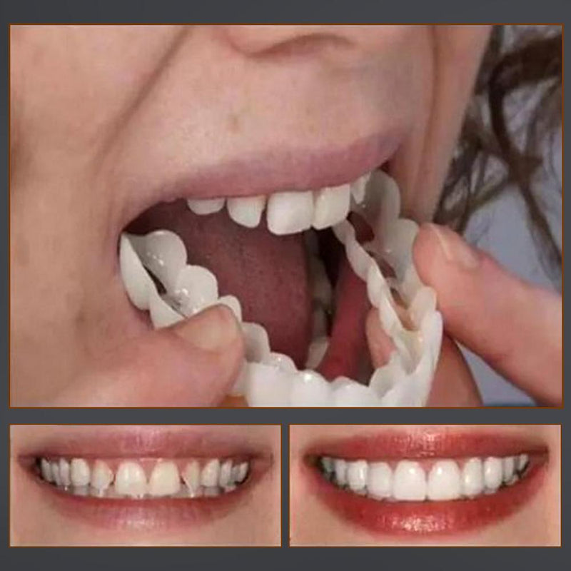 Magic Smile Teeth Brace